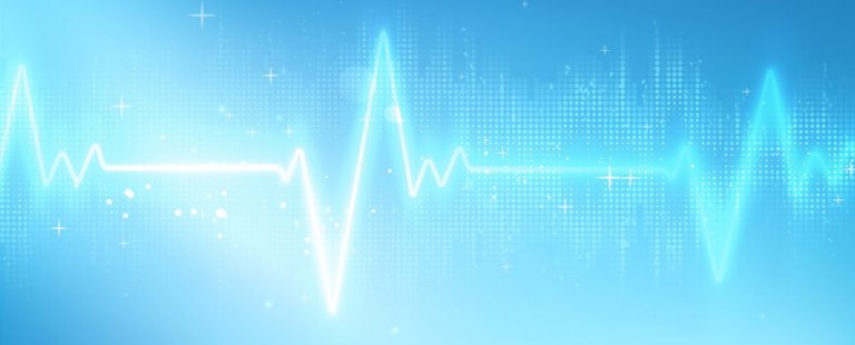 ecg