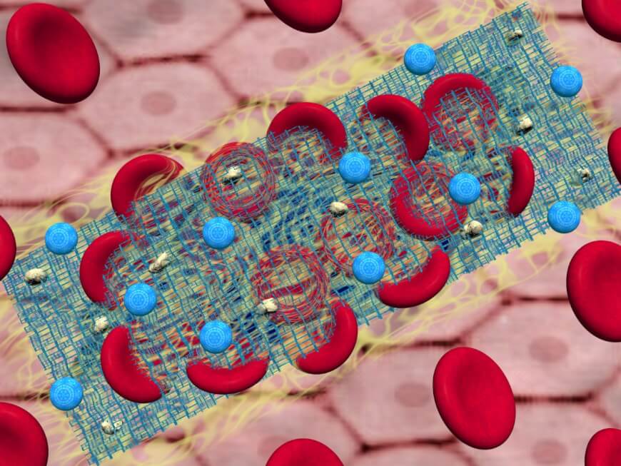 Clottocyte Nanorobots