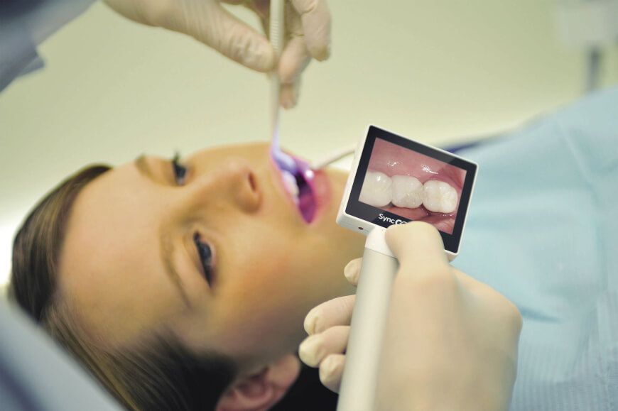 Intra-Oral Camera - Future of Dentistry