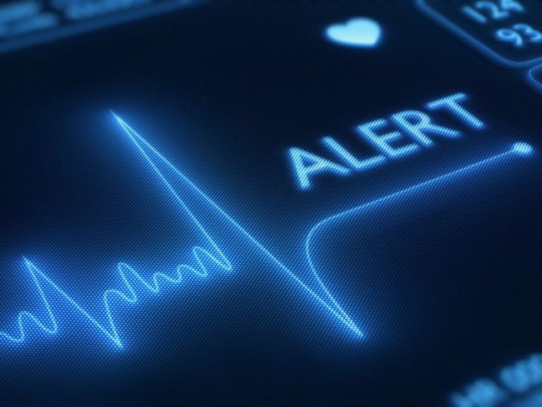 Stroke Alert - WIWE Review