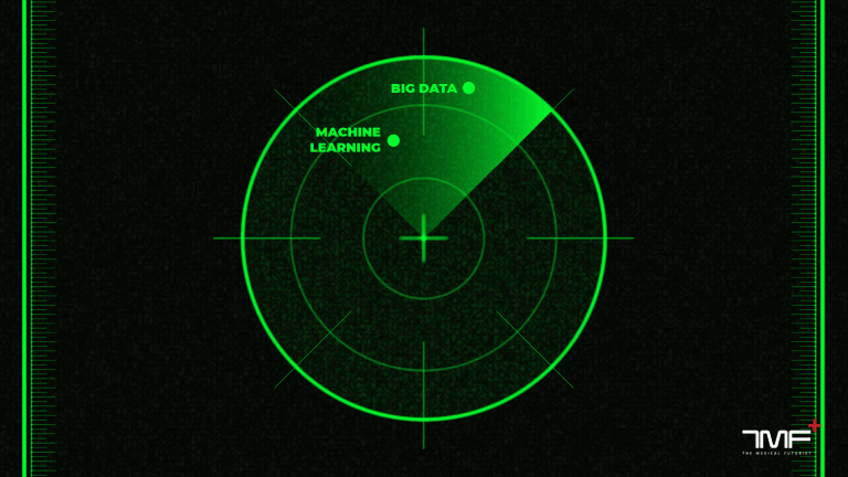 TMF, radar, buzzword
