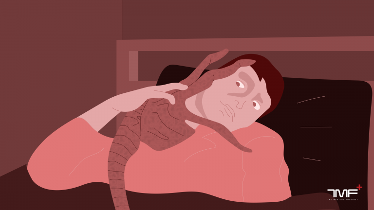 sleep apnea treatment