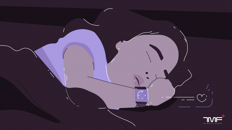 seizure alert watch