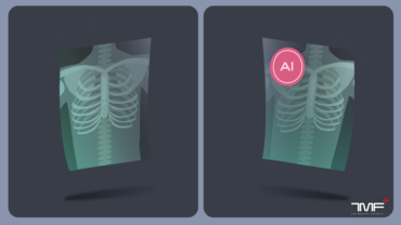 AI, radiomics, radiology, X-ray